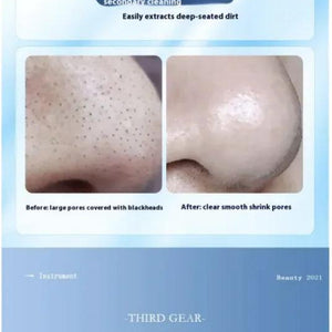 Pore Cleaning Skin Spray Beauty Instrument - Omatic Health