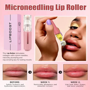 Hydrating Lip Roller with Needles