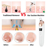 Electric Blackhead Remover - Omatic Health